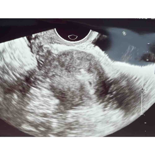 Echo 5 Weken Iemand Een Voorbeeld Zwangerschapspraat 1 24baby Echo 5 Weken Iemand Een Voorbeeld Zwangerschapspraat 1 24baby