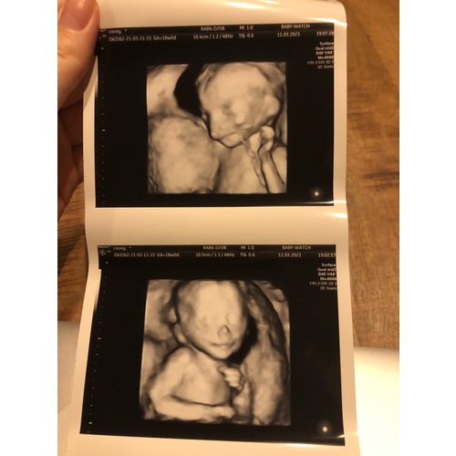 Echo Rotterdam: Waar Een Echo Laten Maken?