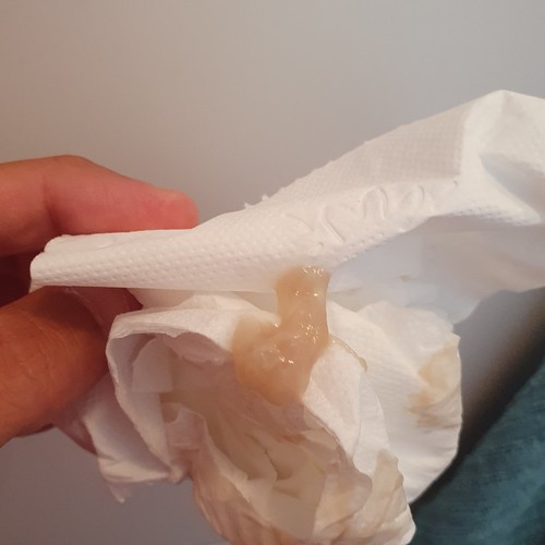 Slijmprop Let Op Met Foto