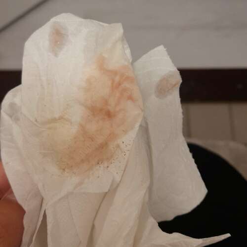 Innestelingsbloeding of begin menstruatie (FOTO) 1 24baby Forum