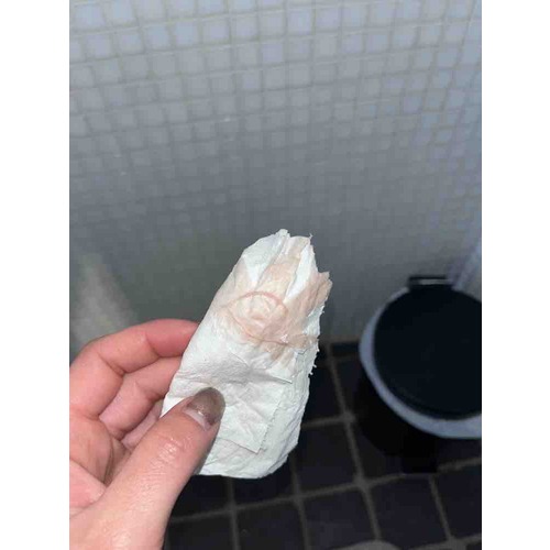 LET OP FOTO!!! (Innestelingsbloeding?) afscheiding 1 24baby Forum LET OP FOTO!!! (Innestelingsbloeding?) afscheiding 1 24baby Forum