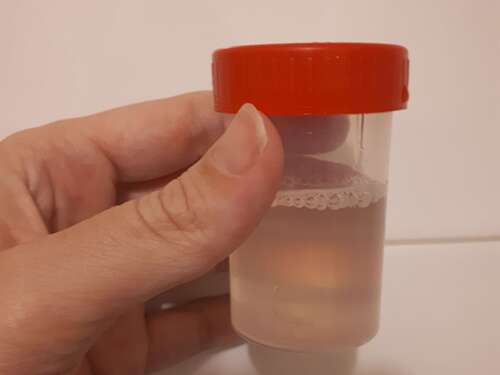 Lek je vruchtwater? Is het urine? Is het afscheiding?