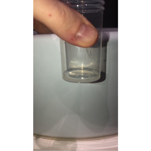 hoe weet je of je vruchtwater verliest