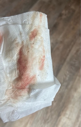 innestelingsbloeding hoe lang